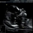 La imagen 1 de la Empresa CENTRO DE MEDICINA FETAL Médico de familia en San Borja LAM