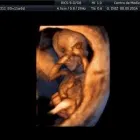 La imagen 2 de la Empresa CENTRO DE MEDICINA FETAL Médico de familia en San Borja LAM