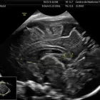 La imagen 3 de la Empresa CENTRO DE MEDICINA FETAL Médico de familia en San Borja LAM