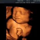 La imagen 4 de la Empresa CENTRO DE MEDICINA FETAL Médico de familia en San Borja LAM