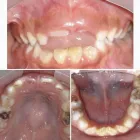 La imagen 2 de la Empresa CENTRO ODONTOLÓGICO MUNDO DENTAL KIDS Odontología Pediátrica en Piura PIU