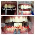 La imagen 3 de la Empresa CLINICA DENTAL ODONTODIGITAL Zirconium Crown en Miraflores LAM