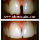 La imagen 10 de la Empresa CLINICA DENTAL ODONTODIGITAL Zirconium Crown en Miraflores LAM