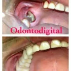 La imagen 11 de la Empresa CLINICA DENTAL ODONTODIGITAL Zirconium Crown en Miraflores LAM