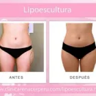 La imagen 2 de la Empresa CLINICA RENACER PERÚ Tratamientos Corporales en Lima LAM