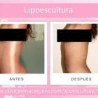 La imagen 6 de la Empresa CLINICA RENACER PERÚ Tratamientos Corporales en Lima LAM