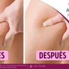 La imagen 13 de la Empresa CURVAS Y BELLEZA Spa en Lima LAM