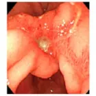 La imagen 1 de la Empresa DR. JORGE DEL CARPIO LAZO Gastroenterologia en Arequipa ARE