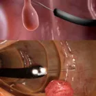 La imagen 2 de la Empresa DR. JORGE DEL CARPIO LAZO Gastroenterologia en Arequipa ARE