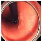 La imagen 3 de la Empresa DR. JORGE DEL CARPIO LAZO Gastroenterologia en Arequipa ARE