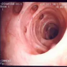 La imagen 4 de la Empresa DR. JORGE DEL CARPIO LAZO Gastroenterologia en Arequipa ARE