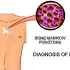 La imagen 2 de la Empresa DR. JOSÉ MÁLAGA ZENTENO Hematologia en Arequipa ARE