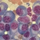 La imagen 5 de la Empresa DR. JOSÉ MÁLAGA ZENTENO Hematologia en Arequipa ARE