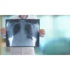 La imagen 1 de la Empresa DR. LUIS H. CHIRINOS ZEGARRA - NEUMOLOGO Neumología en Arequipa ARE