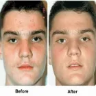 La imagen 5 de la Empresa DR. RAÚL HURTADO PAREDES Dermatologia en Arequipa ARE