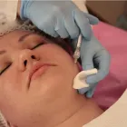 La imagen 1 de la Empresa FERDINAND DE AMAT LOZA - DERMA CENTRO Servicio de depilación en Arequipa ARE