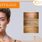 La imagen 3 de la Empresa FERDINAND DE AMAT LOZA - DERMA CENTRO Servicio de depilación en Arequipa ARE