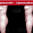 La imagen 6 de la Empresa INSTITUTO DE CIRUGÍA PLÁSTICA JORGE MORENO SAC Rinoplastía en Surco LAM