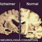 La imagen 7 de la Empresa NEUROCENTER Neurología Pediátrica en Piura PIU