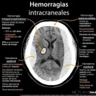 La imagen 8 de la Empresa NEUROCENTER Neurología Pediátrica en Piura PIU