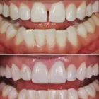 La imagen 2 de la Empresa ODONTOPLUS ODONTOLOGÍA & ESTETICA FACIAL Ortodoncia en Piura PIU