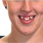 La imagen 3 de la Empresa ODONTOPLUS ODONTOLOGÍA & ESTETICA FACIAL Ortodoncia en Piura PIU