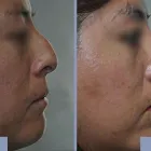 La imagen 1 de la Empresa OTORRINOSALUD Otorrinolaringologia en Arequipa ARE