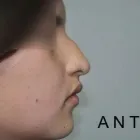 La imagen 2 de la Empresa OTORRINOSALUD Otorrinolaringologia en Arequipa ARE