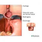 La imagen 3 de la Empresa PALOMINO TORRICO WILFREDO GUILLERMO Gastroenterologia en Arequipa ARE