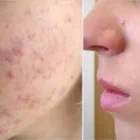 La imagen 4 de la Empresa PEDIATRÍA - DERMATOLOGÍA DR. ALFREDO YONG Pediatra en Lima LAM