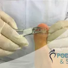 La imagen 4 de la Empresa PODOLOGÍA Y SALUD Spa en Lima LAM