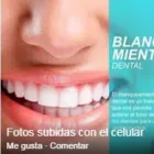 La imagen 3 de la Empresa QUALYDENT Periodoncia en Metropolitana De Lima Perú