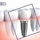 La imagen 1 de la Empresa R3D CONSULTORIOS ODONTOLÓGICOS Odontologia en Lima LAM