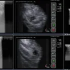 La imagen 4 de la Empresa RADIÓLOGA - DRA. CLAUDIA R. CARACELA ZEBALLOS Radiología pediátrica en Arequipa ARE