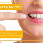 La imagen 3 de la Empresa SOLUCIÓN DENTAL PERÚ SAC Ortodoncia en Lima LAM