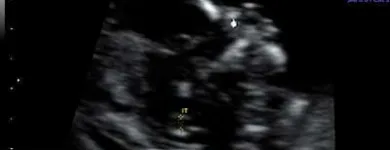 La imagen 1 de la Empresa CENTRO DE MEDICINA FETAL Médico de familia en San Borja LAM