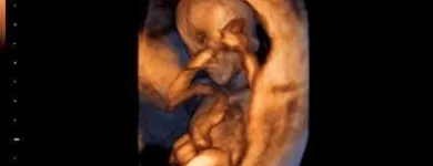 La imagen 2 de la Empresa CENTRO DE MEDICINA FETAL Médico de familia en San Borja LAM