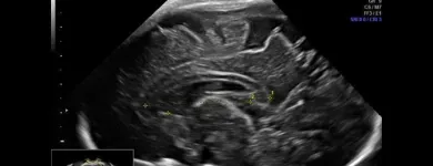La imagen 3 de la Empresa CENTRO DE MEDICINA FETAL Médico de familia en San Borja LAM