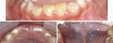 La imagen 2 de la Empresa CENTRO ODONTOLÓGICO MUNDO DENTAL KIDS Odontología Pediátrica en Piura PIU