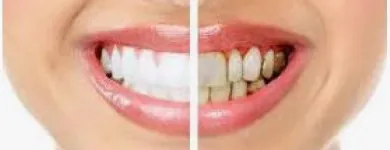 La imagen 5 de la Empresa CLÍNICA DENTAL CARLOS DEL AGUILA Odontologia en Lima LAM