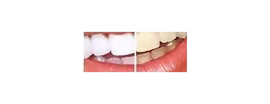 La imagen 3 de la Empresa CONSULTORIO ODONTOLÓGICO GCC Periodoncista de implantes dentales en Lima LAM