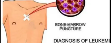 La imagen 2 de la Empresa DR. JOSÉ MÁLAGA ZENTENO Hematologia en Arequipa ARE