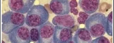 La imagen 5 de la Empresa DR. JOSÉ MÁLAGA ZENTENO Hematologia en Arequipa ARE