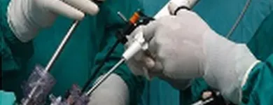 La imagen 3 de la Empresa DR. MANUEL ALBERTO ENRIQUEZ MESONES Cirugia en Lima LAM