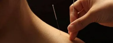 La imagen 2 de la Empresa FISIO LLANTEN Centro de rehabilitación en Santiago de Surco LAM