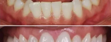 La imagen 2 de la Empresa ODONTOPLUS ODONTOLOGÍA & ESTETICA FACIAL Ortodoncia en Piura PIU