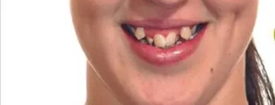 La imagen 3 de la Empresa ODONTOPLUS ODONTOLOGÍA & ESTETICA FACIAL Ortodoncia en Piura PIU