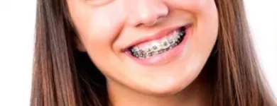 La imagen 4 de la Empresa ODONTOPLUS ODONTOLOGÍA & ESTETICA FACIAL Ortodoncia en Piura PIU