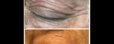 La imagen 3 de la Empresa PLEXR PLUS Cirugía Plástica en Metropolitana De Lima Perú