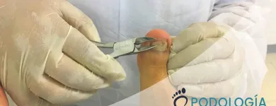 La imagen 4 de la Empresa PODOLOGÍA Y SALUD Spa en Lima LAM